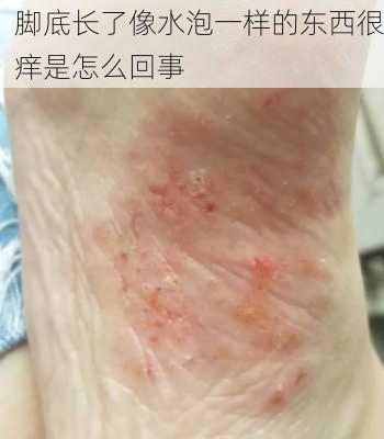 脚底长了像水泡一样的东西很痒是怎么回事